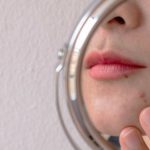 Unmasking Adult Acne at 30: Causes and Solutions